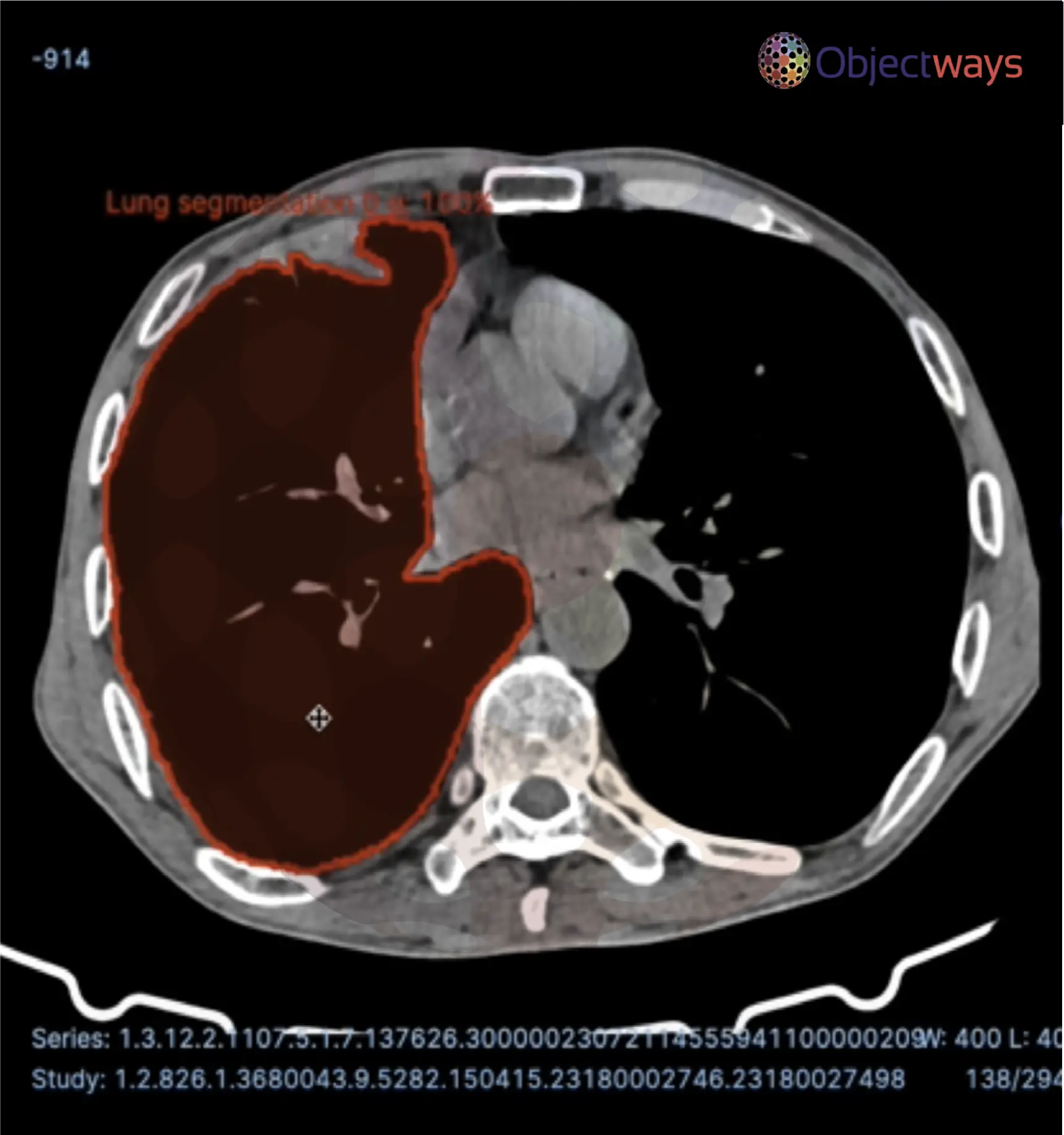 medical coding blog